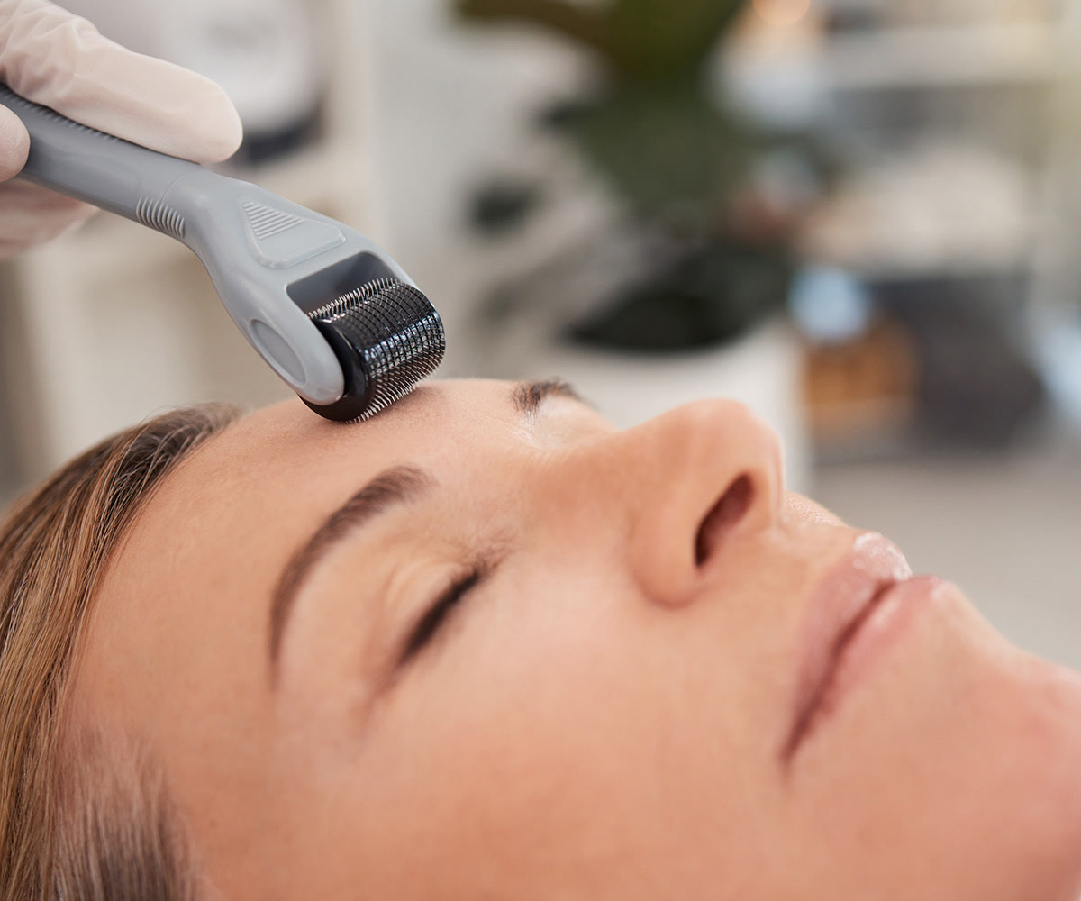 Close-up of a derma roller being used on a woman's forehead during a facial procedure